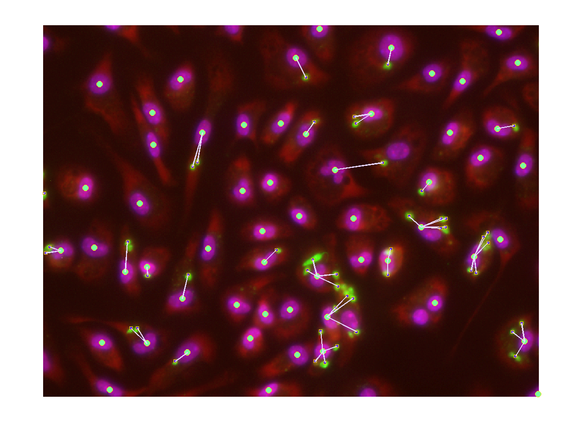Leishmania-infected macrophages image