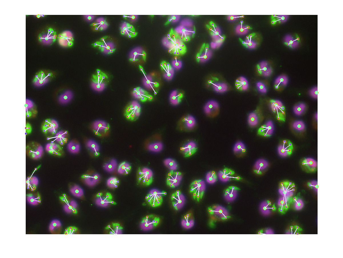 Leishmania-infected macrophages image
